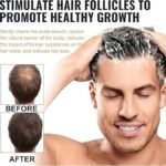 Root Activating Shampoo 100 ml Pack of 1 - Image 6
