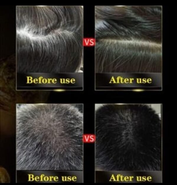 BLOSDREAM Black Hair Shampoo 3 in 1-100ml (Pack of 2) - Image 2
